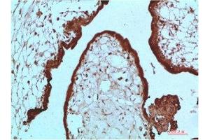 Immunohistochemical analysis of paraffin-embedded Human Placenta Tissue using HP-1 α Mouse mAb diluted at 1:200 (CBX5 antibody)