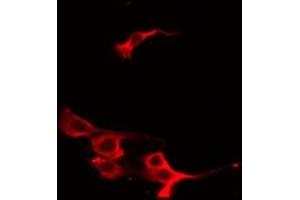 ABIN6267547 staining HeLa by IF/ICC. (VASP antibody  (pSer239))