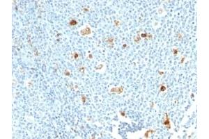 Formalin-fixed, paraffin-embedded human tonsil stained with Calprotectin antibody (CPT/1028) (Calprotectin antibody)