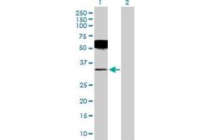 Western Blot analysis of UCHL1 expression in transfected 293T cell line by UCHL1 MaxPab polyclonal antibody. (UCHL1 antibody  (AA 1-223))