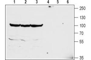 Solute Carrier Family 6 (Neurotransmitter Transporter, Glycine), Member 5 (SLC6A5) peptide