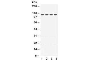 Western blot testing of 1) rat kidney, 2) mouse kidney, 3) human HeLa and 4) human A431 lysate with MR antibody. (NR3C2 antibody)