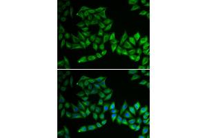Immunofluorescence analysis of U2OS cell using TPMT antibody. (TPMT antibody)
