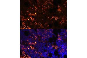 Immunofluorescence analysis of rat bone marrow cells using GPR55 antibody (ABIN6130402, ABIN6141351, ABIN6141352 and ABIN6216688) at dilution of 1:100. (GPR55 antibody  (AA 210-319))