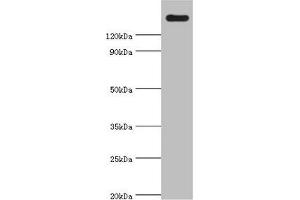 Western blot All lanes: CARD11 antibody at 4 μg/mL + K562 whole cell lysate Secondary Goat polyclonal to rabbit IgG at 1/10000 dilution Predicted band size: 133 kDa Observed band size: 133 kDa (CARD11 antibody  (AA 985-1154))