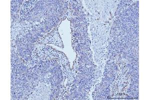 IHC analysis of CD93 using anti-CD93 antibody (ABIN7602865). (CD93 antibody  (C-Term))