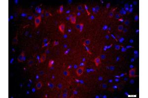 Paraformaldehyde-fixed, paraffin embedded rat brain tissue, Antigen retrieval by boiling in sodium citrate buffer(pH6) for 15min, Block endogenous peroxidase by 3% hydrogen peroxide for 20 minutes, Blocking buffer (normal goat serum) at 37°C for 30min, Antibody incubation with TMEM158 Polyclonal Antibody, Unconjugated  at 1:200 overnight at 4°C, followed by a conjugated secondary and DAPI staining (TMEM158 antibody  (AA 188-260))