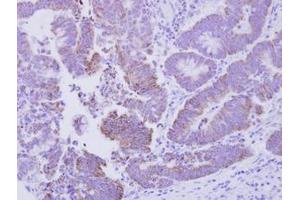 Image no. 1 for anti-CG1458 (CG1458) (AA 1-133) antibody (ABIN1496301) (CG1458 antibody  (AA 1-133))