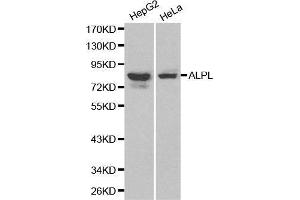 Western blot analysis of HepG2 cell and Hela cell lysate using ALPL antibody. (ALPL antibody  (AA 20-270))