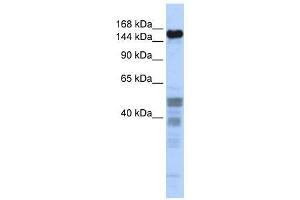 ZNF335 antibody used at 0. (ZNF335 antibody  (Middle Region))