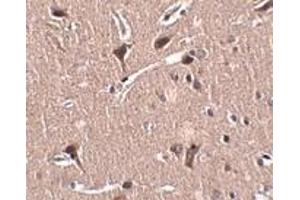 Immunohistochemistry (IHC) image for anti-Zinc Finger Protein 667 (ZNF667) (N-Term) antibody (ABIN1031458)