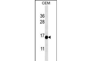 ATAD4 Antibody (C-term) (ABIN657177 and ABIN2837907) western blot analysis in CEM cell line lysates (35 μg/lane).