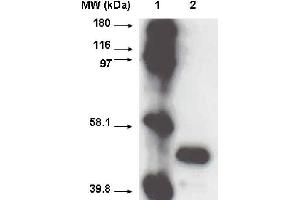 Western blot using CYP2A6 antibody  on recombinant cytochrome p450 at 1 µg/ml. (CYP2A6 antibody  (C-Term))