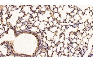 Immunohistochemistry (IHC) image for anti-Leukemia Inhibitory Factor Receptor alpha (LIFR) (AA 641-790) antibody (ABIN7437698)