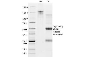 SDS-PAGE Analysis Purified CD28 Mouse Monoclonal Antibody (CB28). (CD28 antibody  (PE))
