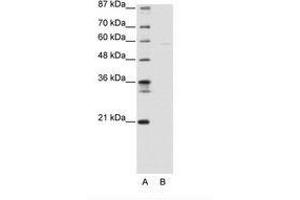 Image no. 1 for anti-SWI/SNF Related, Matrix Associated, Actin Dependent Regulator of Chromatin, Subfamily D, Member 3 (SMARCD3) (AA 139-188) antibody (ABIN6736140) (SMARCD3 antibody  (AA 139-188))