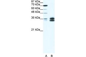 WB Suggested Anti-RELA Antibody Titration:  1. (NF-kB p65 antibody  (N-Term))