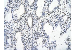 Immunohistochemistry (IHC) image for anti-FOS-Like Antigen 1 (FOSL1) (Middle Region) antibody (ABIN2777265)