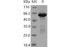 Western Blotting (WB) image for Tribbles Pseudokinase 2 (TRIB2) protein (GST tag,His tag) (ABIN7198335) (TRIB2 Protein (GST tag,His tag))