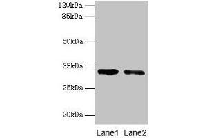 Western blot All lanes: SLA antibody at 5 μg/mL Lane 1: 293T whole cell lysate Lane 2: A431 whole cell lysate Secondary Goat polyclonal to rabbit IgG at 1/10000 dilution Predicted band size: 32, 20, 34, 28, 36 kDa Observed band size: 32 kDa (SLA antibody  (AA 2-276))
