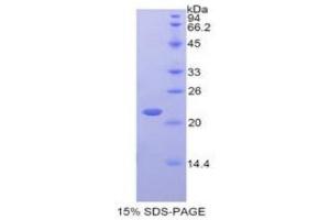 SDS-PAGE (SDS) image for Interferon, alpha 4 (IFNa4) (AA 33-189) protein (His tag) (ABIN2125374) (IFNA4 Protein (AA 33-189) (His tag))