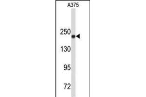 Western Blotting (WB) image for anti-Topoisomerase (DNA) II alpha 170kDa (TOP2A) (AA 1167-1196), (C-Term) antibody (ABIN653195)