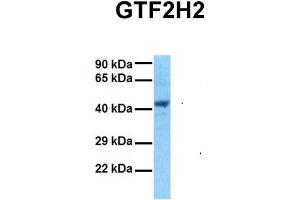 Host:  Rabbit  Target Name:  GTF2H2  Sample Tissue:  Human 293T  Antibody Dilution:  1. (GTF2H2 antibody  (C-Term))