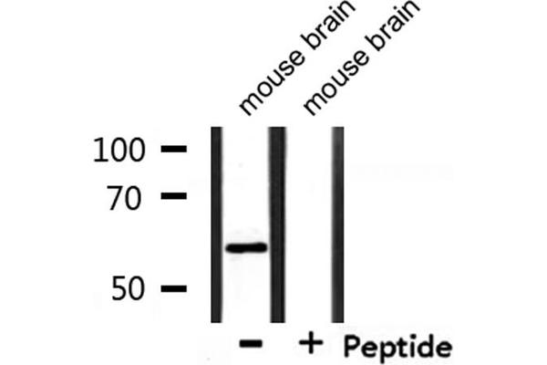 DAK antibody  (Internal Region)