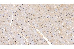 Detection of MMP2 in Human Cardiac Muscle Tissue using Polyclonal Antibody to Matrix Metalloproteinase 2 (MMP2) (MMP2 antibody  (AA 110-660))
