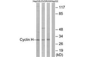 Western blot analysis of extracts from HepG2/LOVO/RAW264. (Cyclin H antibody  (AA 274-323))