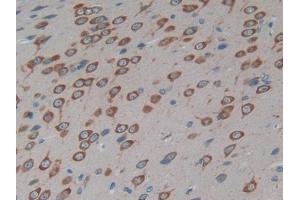 DAB staining on IHC-P; Samples: Rat Brain Tissue (Cx40/GJA5 antibody  (AA 50-303))