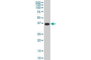 MEOX2 monoclonal antibody (M02), clone 5A6 Western Blot analysis of MEOX2 expression in HeLa . (MEOX2 antibody  (AA 1-303))