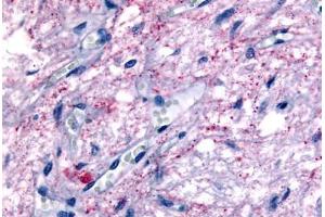 GPR50 antibody  (Cytoplasmic Domain)