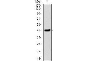Western blot analysis using SERPINE1 mAb against human SERPINE1 (AA: 194-316) recombinant protein.