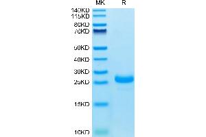 Interleukin 33 (IL33) (AA 109-270) protein (His tag)