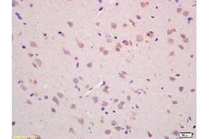 Formalin-fixed and paraffin embedded rat brain labeled with Rabbit Anti CHAC1 Polyclonal Antibody, Unconjugated (ABIN872557) at 1:200 followed by conjugation to the secondary antibody and DAB staining