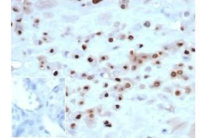 IHC analysis of formalin-fixed, paraffin-embedded human placenta. (Recombinant CDKN1C antibody)