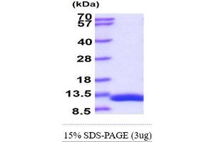 SDS-PAGE (SDS) image for Diazepam Binding Inhibitor (DBI) (AA 1-87) protein (His tag) (ABIN667004)