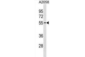 Western Blotting (WB) image for anti-Thioredoxin-Related Transmembrane Protein 3 (TMX3) antibody (ABIN3001033)