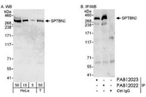 Western blot analysis of SPTBN2 in HeLa whole cell lysate (5, 15 and 50 ug for WB; 1 mg for IP, 20% of IP loaded) and HEK 293T (Bosc 23) (T : 50 ug) cells with SPTBN2 polyclonal antibody . (Spectrin, Beta, Non-erythrocytic 2 (SPTBN2) (C-Term) antibody)