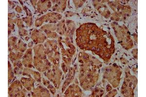IHC image of ABIN7169218 diluted at 1:600 and staining in paraffin-embedded human pancreatic tissue performed on a Leica BondTM system. (VRK2 antibody  (AA 317-472))