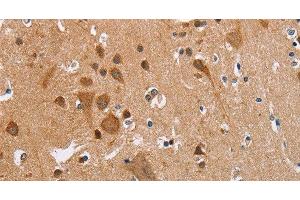 Immunohistochemistry of paraffin-embedded Human brain using CK-13 Polyclonal Antibody at dilution of 1:35 (Cytokeratin 13 antibody)