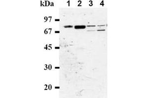 Western Blotting (WB) image for anti-RAD17 (RAD17) antibody (ABIN492574)