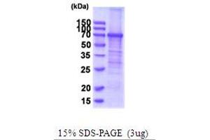 SDS-PAGE (SDS) image for Transferrin Receptor (p90, CD71) (TFRC) (AA 89-760) protein (His tag) (ABIN5854102)
