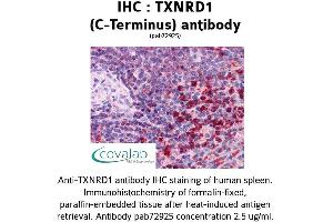 Image no. 1 for anti-Thioredoxin Reductase 1 (TXNRD1) (C-Term) antibody (ABIN1740489) (TXNRD1 antibody  (C-Term))