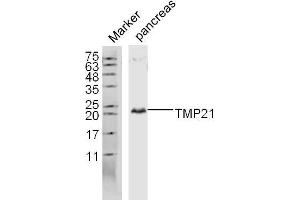 Lane 1: Mouse pancreas lysates probed with TMP21 Polyclonal Antibody, Unconjugated  at 1:300 overnight at 4˚C. (TMED10 antibody  (AA 101-200))