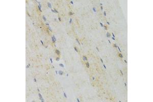 Immunohistochemistry of paraffin-embedded mouse skeletal muscle using GEMIN2 Antibody. (SIP1 antibody)