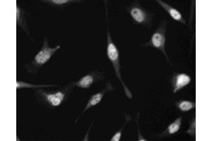 Immunofluorescent staining of HeLa (ATCC CCL-2) cells. (CDKN1B antibody)