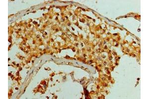 Immunohistochemistry of paraffin-embedded human testis tissue using ABIN7158724 at dilution of 1:100 (LSD1 antibody  (AA 100-150))