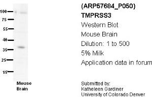 Image no. 3 for anti-Transmembrane Protease, Serine 3 (TMPRSS3) (N-Term) antibody (ABIN785924) (TMPRSS3 antibody  (N-Term))